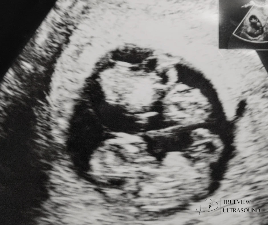 5D ultrasounds