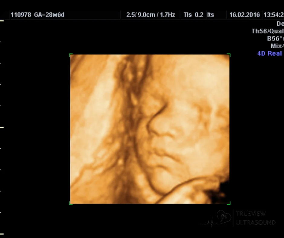 5D or 8K Ultrasound