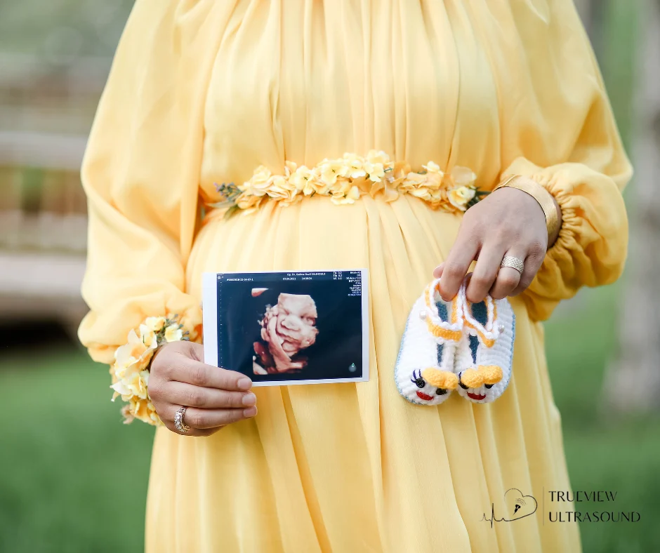 Creative Gender Reveal Ideas with Ultrasound Photos
