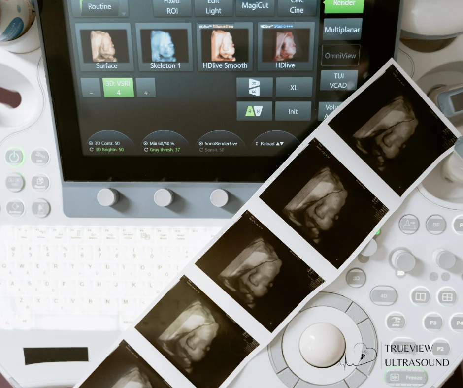 How Elective Ultrasounds Differ from Medical Ultrasounds