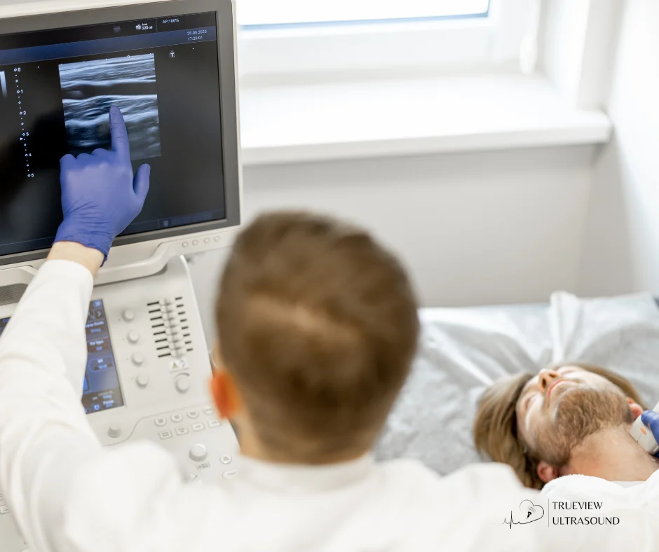 Carotid Ultrasounds