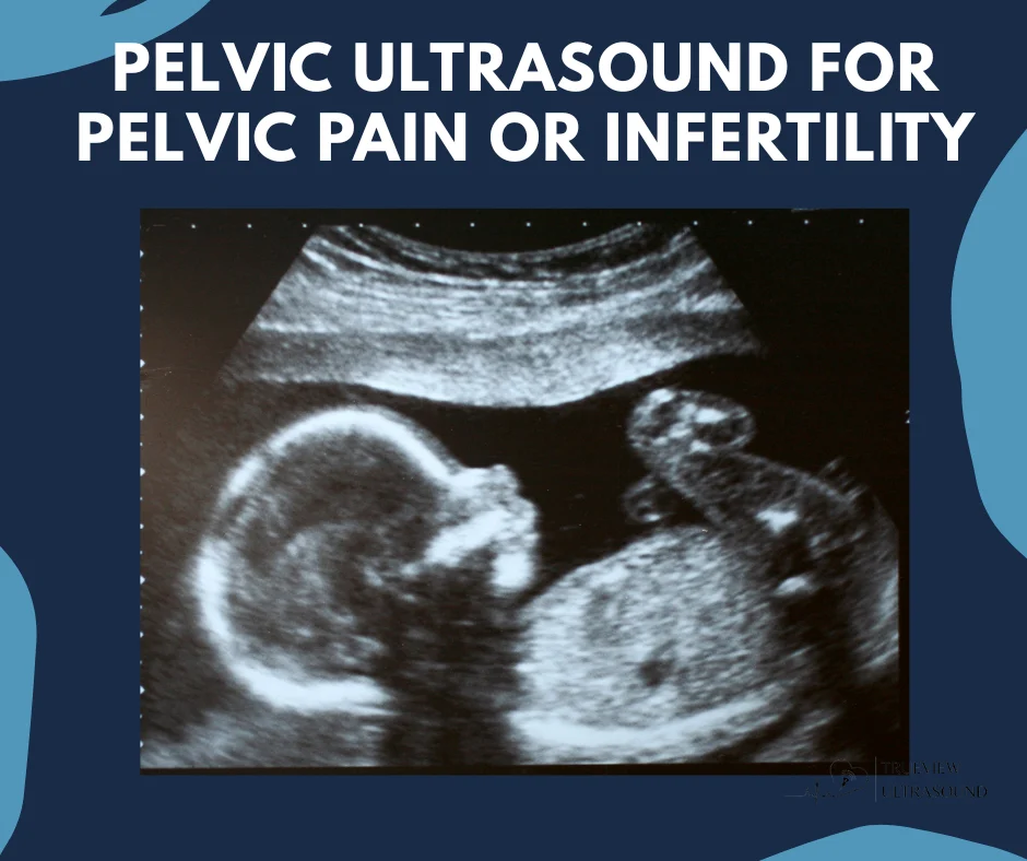 Pelvic Ultrasound for Pelvic Pain and Infertility