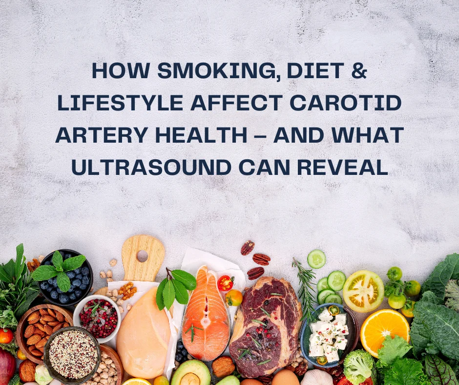 Smoking Diet and Lifestyle Affect Carotid Artery