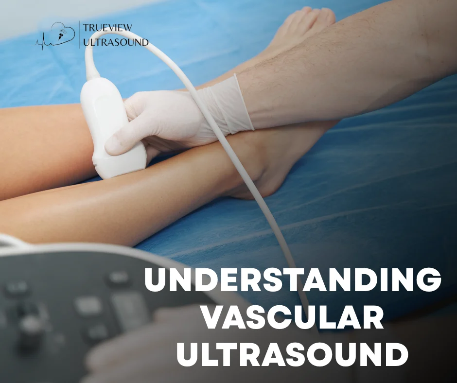 vascular ultrasounds