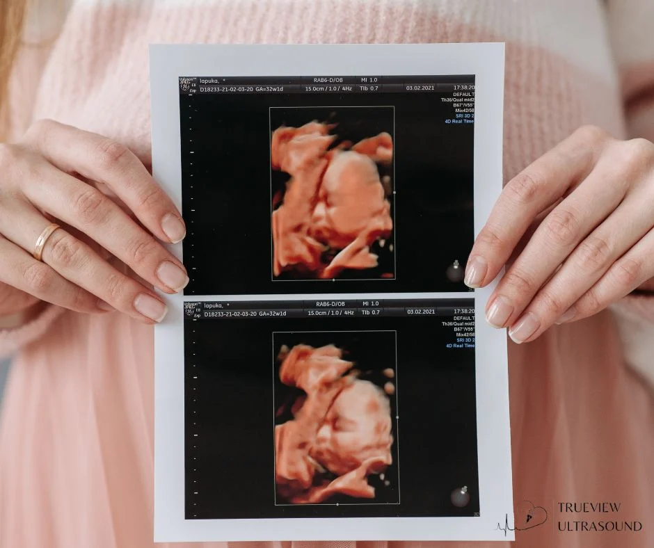 5D Ultrasound for Expectant Parents