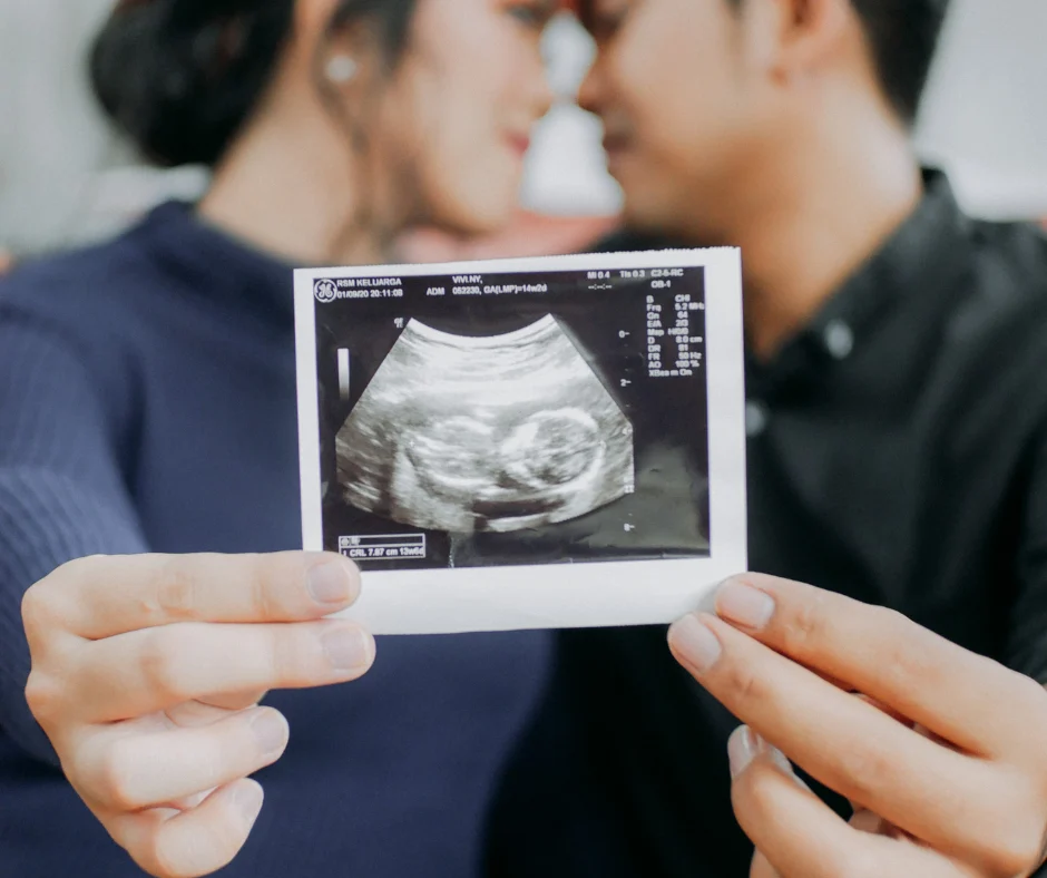 5D Ultrasound in Roseville