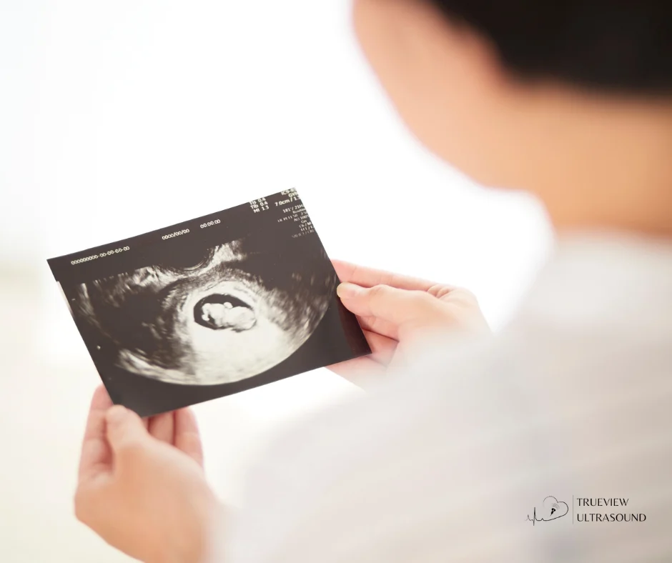 HD-Live Ultrasound in Roseville