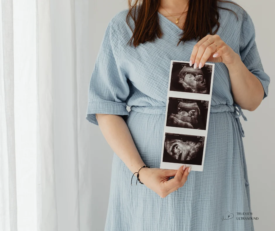 How Often Should You Have an Ultrasound During Pregnancy A Trimester-by-Trimester Guide