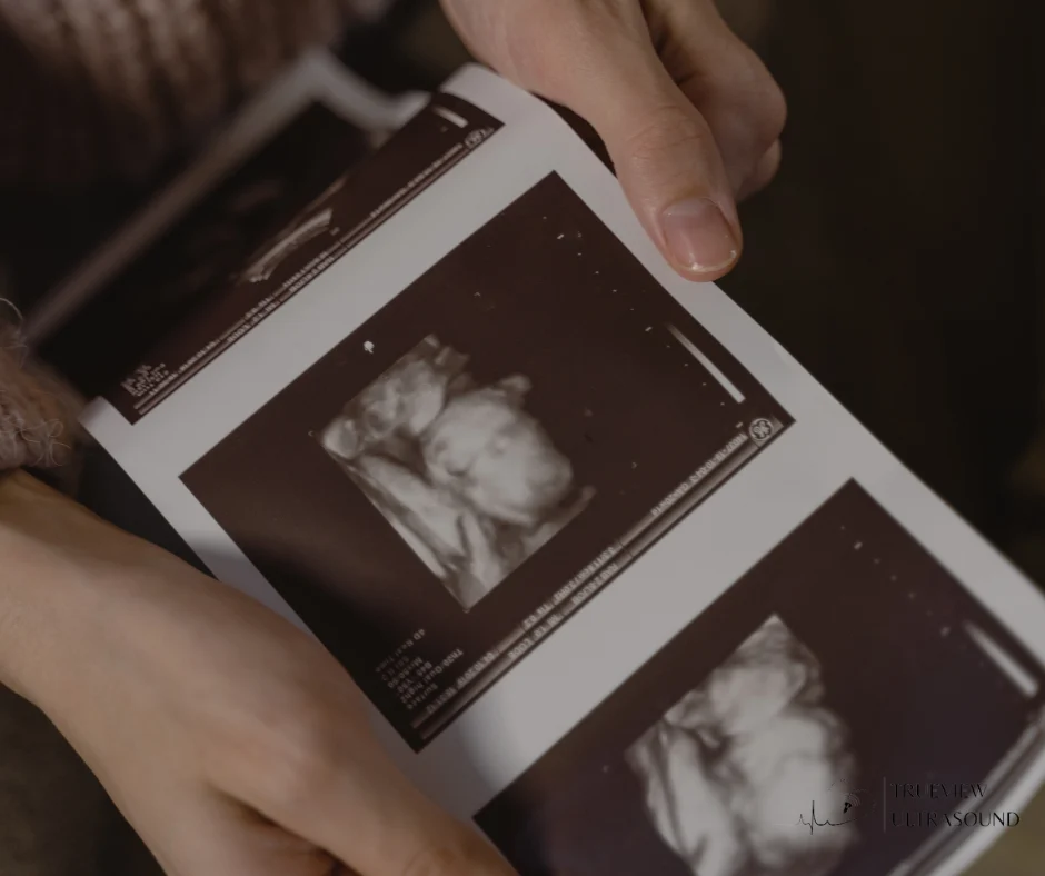 Keepsake Ultrasounds