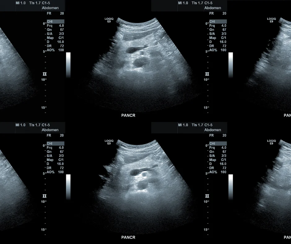 non-obstetric ultrasound screening