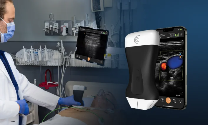 Portable, Wireless, Handheld Ultrasound Devices