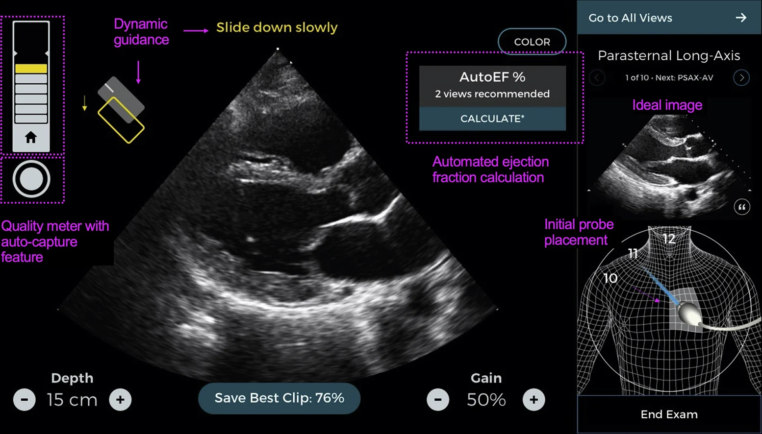 AI ultrasound, predictive analytics imaging, anomaly detection ultrasound, diagnostic imaging AI, matrix probes