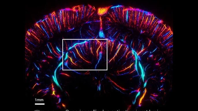 Super-Resolution Ultrasound & Ultrasound Localization Microscopy (ULM)